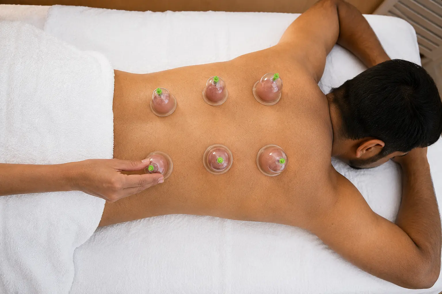 Dry Cupping therapy at Cureवेदा, Andheri West